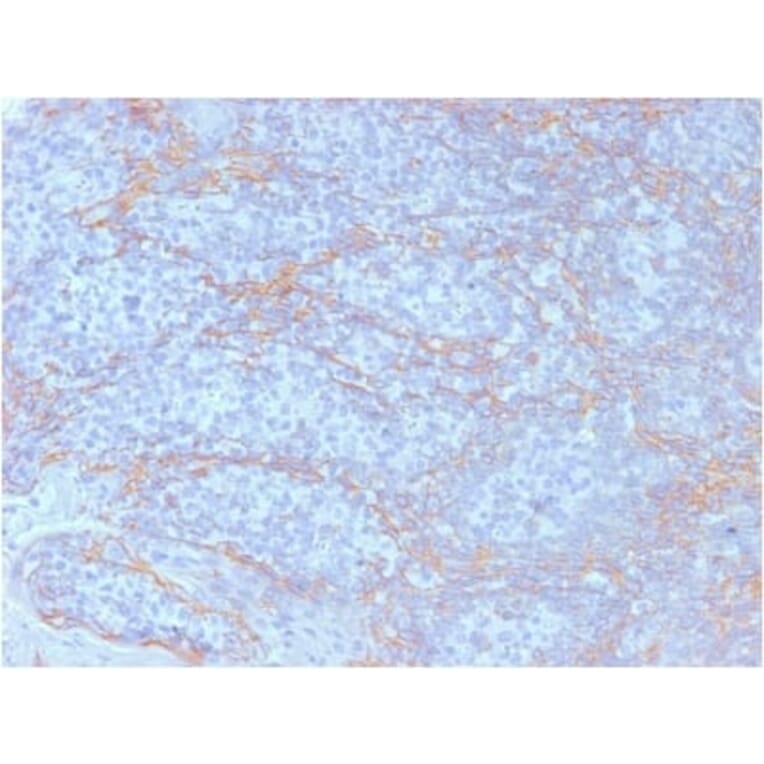 Immunohistochemistry (formalin-fixed, paraffin-embedded) - Anti-beta Catenin Antibody [CTNNB1/2098] (CF®740) (A353817) - Antibodies.com