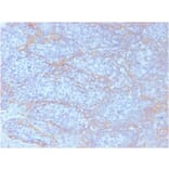 Immunohistochemistry (formalin-fixed, paraffin-embedded) - Anti-beta Catenin Antibody [CTNNB1/2098] (CF®740) (A353817) - Antibodies.com