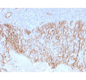 Immunohistochemistry (formalin-fixed, paraffin-embedded) - Anti-beta Catenin Antibody [CTNNB1/2099] (CF®405S) (A353821) - Antibodies.com