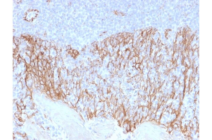 Immunohistochemistry (formalin-fixed, paraffin-embedded) - Anti-beta Catenin Antibody [CTNNB1/2099] (CF®405S) (A353821) - Antibodies.com