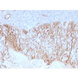 Immunohistochemistry (formalin-fixed, paraffin-embedded) - Anti-beta Catenin Antibody [CTNNB1/2099] (CF®405S) (A353821) - Antibodies.com