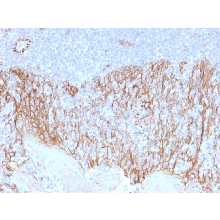 Immunohistochemistry (formalin-fixed, paraffin-embedded) - Anti-beta Catenin Antibody [CTNNB1/2099] (CF®488A) (A353826) - Antibodies.com