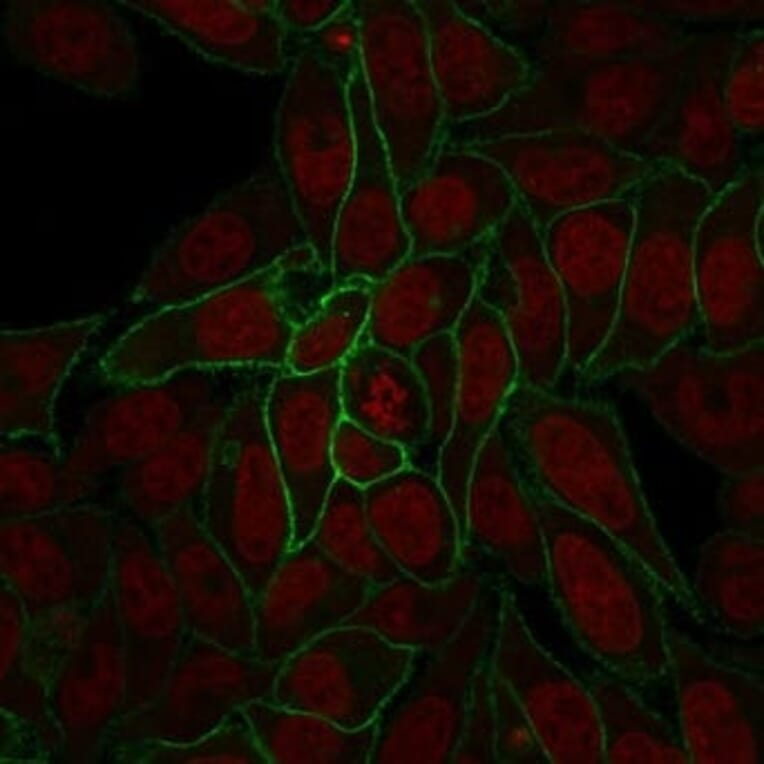 Immunofluorescence - Anti-beta Catenin Antibody [rCTNNB1/2173] (CF®405S) (A353829) - Antibodies.com