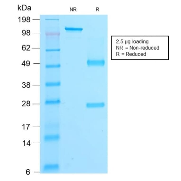 SDS-PAGE - Anti-beta Catenin Antibody [rCTNNB1/2173] (CF®647) (A353831) - Antibodies.com