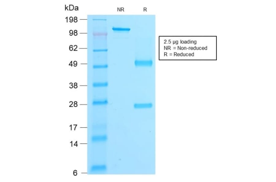 SDS-PAGE - Anti-beta Catenin Antibody [rCTNNB1/2173] (CF®740) (A353833) - Antibodies.com