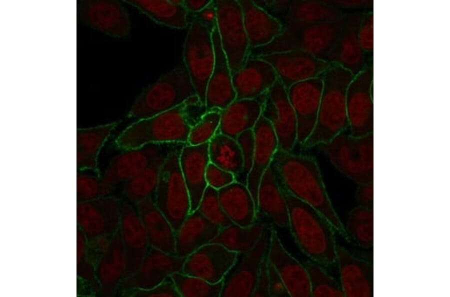 Immunofluorescence - Anti-beta Catenin Antibody [rCTNNB1/2173] (CF®740) (A353833) - Antibodies.com