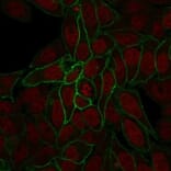 Immunofluorescence - Anti-beta Catenin Antibody [rCTNNB1/2173] (CF®740) (A353833) - Antibodies.com