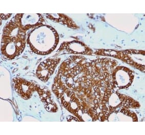 Immunohistochemistry (formalin-fixed, paraffin-embedded) - Anti-beta Catenin Antibody [rCTNNB1/2173] (CF®488A) (A353834) - Antibodies.com