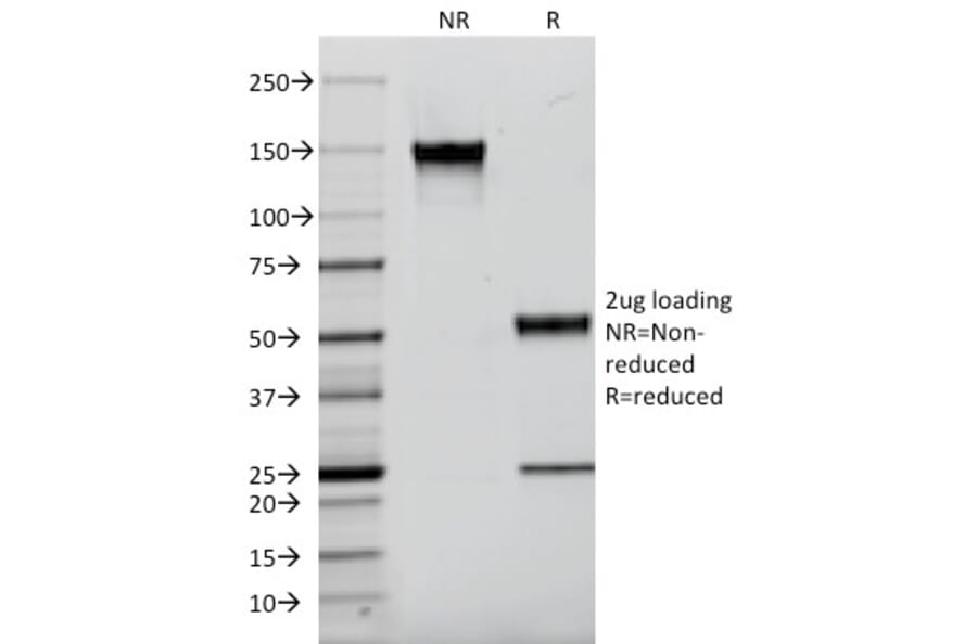 SDS-PAGE - Anti-EGFR Antibody [F4] (CF®647) (A353839) - Antibodies.com