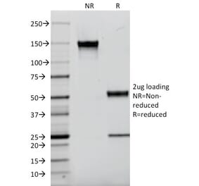 SDS-PAGE - Anti-EGFR Antibody [F4] (CF®740) (A353841) - Antibodies.com