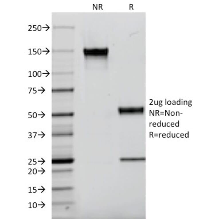 SDS-PAGE - Anti-EGFR Antibody [F4] (CF®594) (A353843) - Antibodies.com