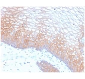 Immunohistochemistry (formalin-fixed, paraffin-embedded) - Anti-E-Cadherin Antibody [CDH1/2208R] (CF®405S) (A353845) - Antibodies.com