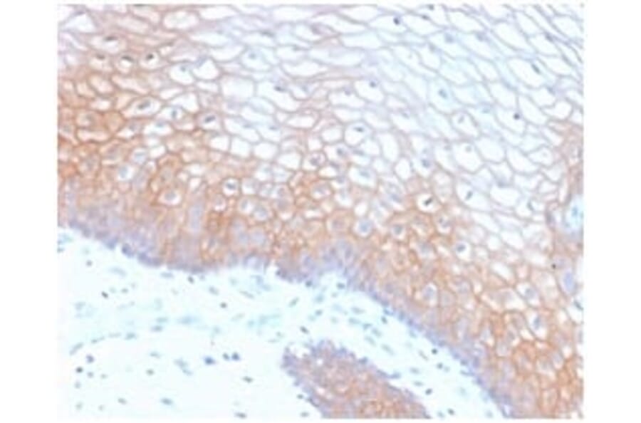 Immunohistochemistry (formalin-fixed, paraffin-embedded) - Anti-E-Cadherin Antibody [CDH1/2208R] (CF®405S) (A353845) - Antibodies.com