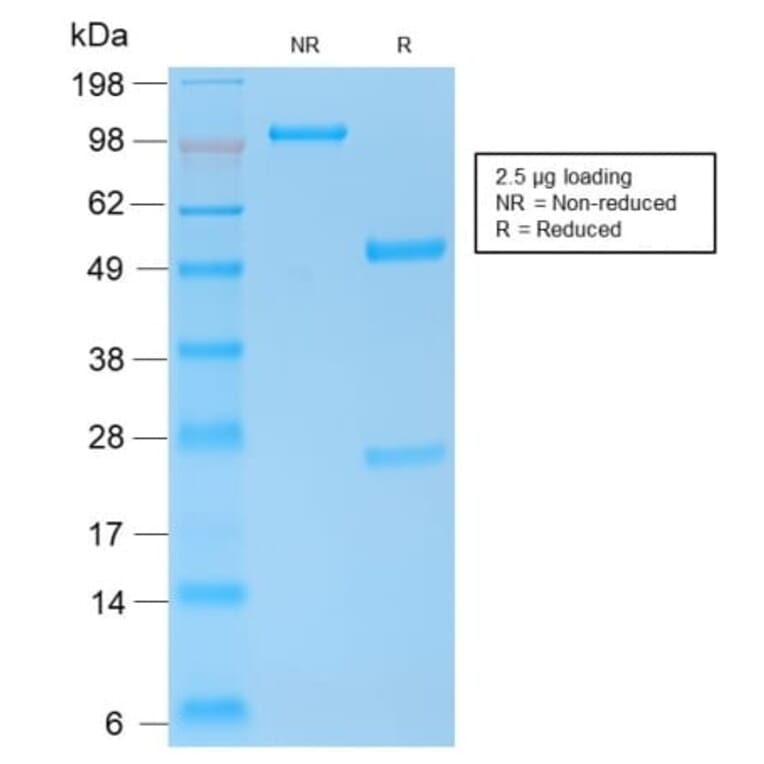 SDS-PAGE - Anti-E-Cadherin Antibody [CDH1/2208R] (CF®405S) (A353845) - Antibodies.com