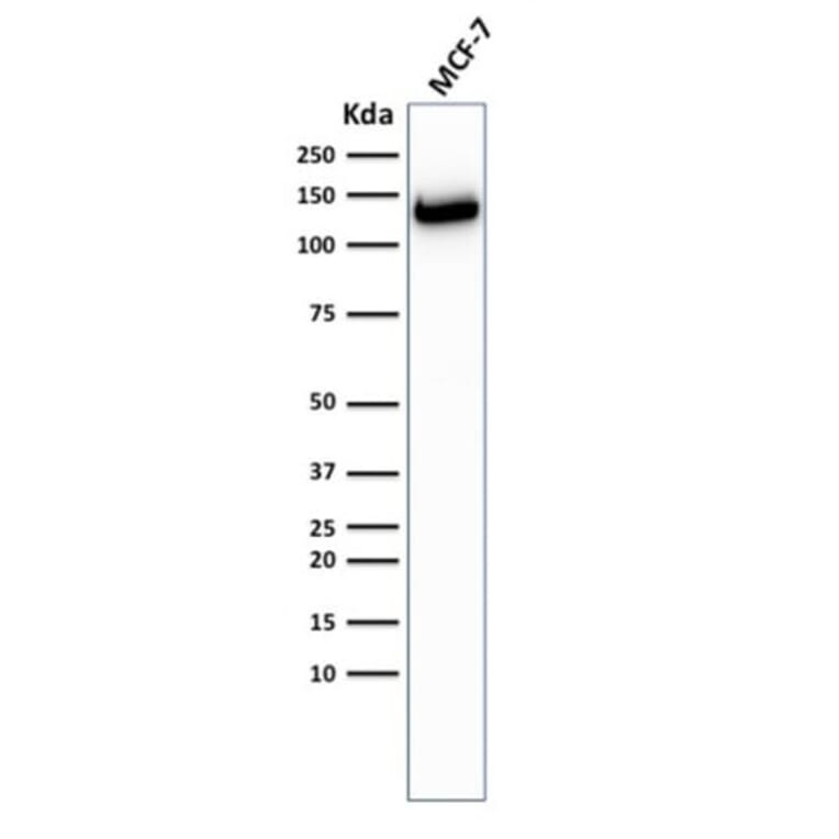 Wstern Blot - Anti-E-Cadherin Antibody [CDH1/2208R] (CF®568) (A353848) - Antibodies.com