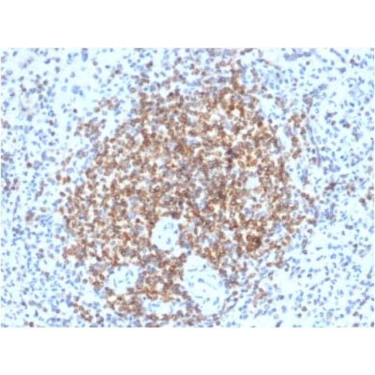 Immunohistochemistry (formalin-fixed, paraffin-embedded) - Anti-Bcl-2 Antibody [BCL2/2210R] (CF®405S) (A353853) - Antibodies.com