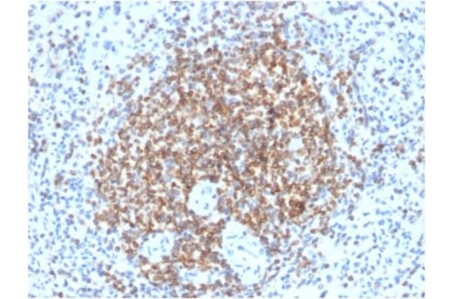 Immunohistochemistry (formalin-fixed, paraffin-embedded) - Anti-Bcl-2 Antibody [BCL2/2210R] (CF®740) (A353857) - Antibodies.com
