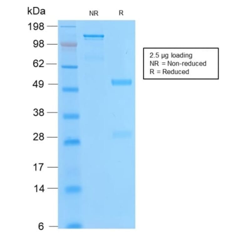 SDS-PAGE - Anti-Bcl-2 Antibody [BCL2/2210R] (CF®740) (A353857) - Antibodies.com