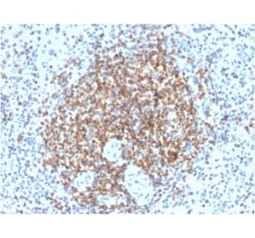 Immunohistochemistry (formalin-fixed, paraffin-embedded) - Anti-Bcl-2 Antibody [BCL2/2210R] (Biotin) (A353860) - Antibodies.com