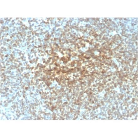 Immunohistochemistry (formalin-fixed, paraffin-embedded) - Anti-Bcl-2 Antibody [rBCL2/782] (CF®647) (A353863) - Antibodies.com