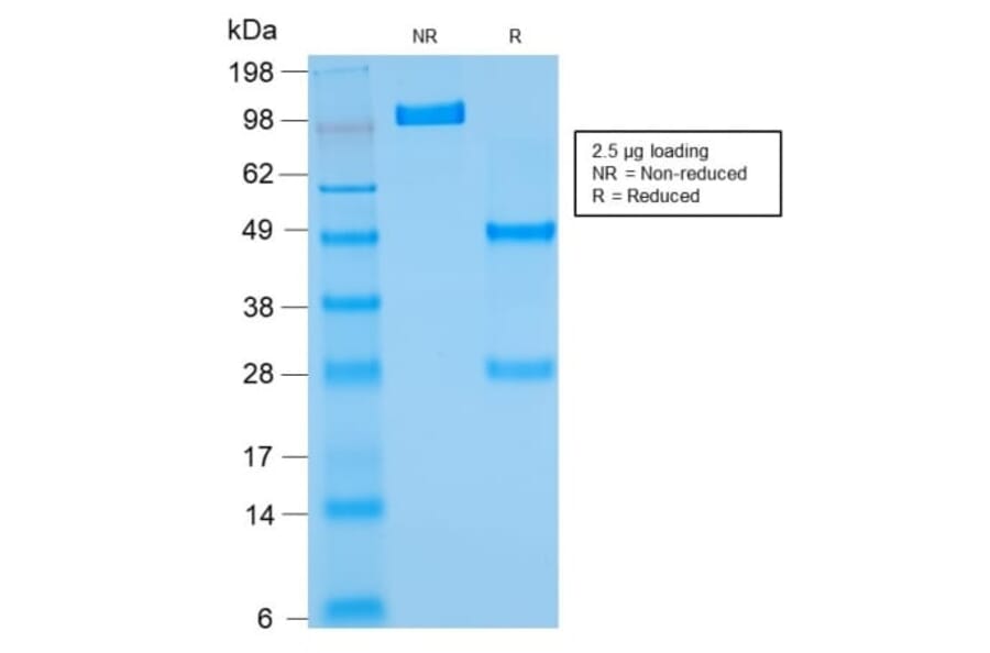 SDS-PAGE - Anti-Bcl-2 Antibody [rBCL2/782] (CF®647) (A353863) - Antibodies.com