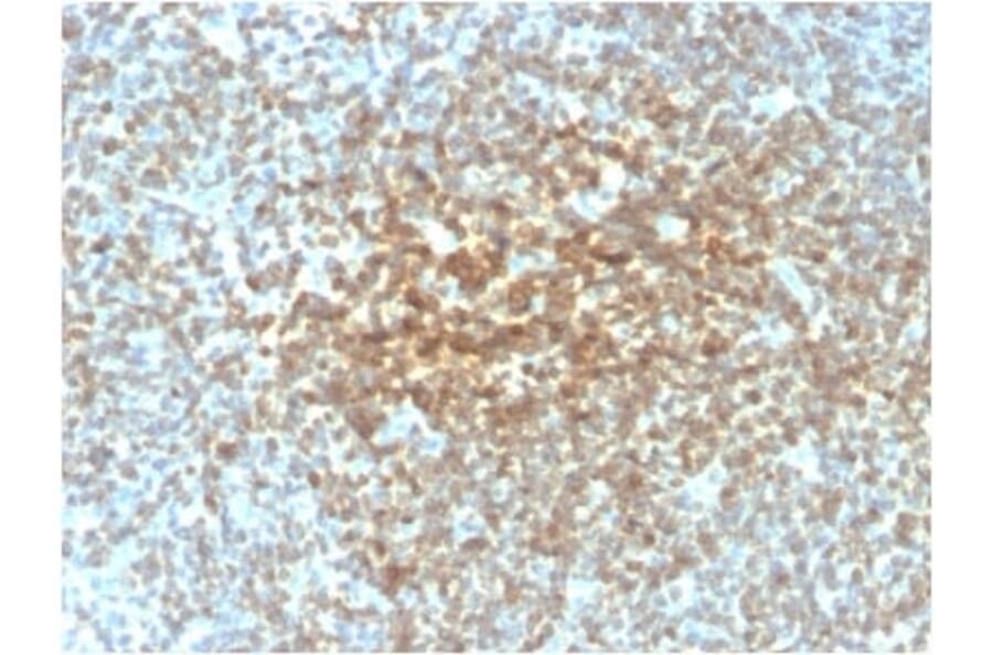 Immunohistochemistry (formalin-fixed, paraffin-embedded) - Anti-Bcl-2 Antibody [rBCL2/782] (CF®568) (A353864) - Antibodies.com