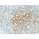 Immunohistochemistry (formalin-fixed, paraffin-embedded) - Anti-Bcl-2 Antibody [rBCL2/782] (CF®488A) (A353866) - Antibodies.com
