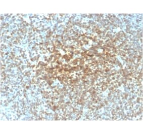 Immunohistochemistry (formalin-fixed, paraffin-embedded) - Anti-Bcl-2 Antibody [rBCL2/782] (CF®594) (A353867) - Antibodies.com