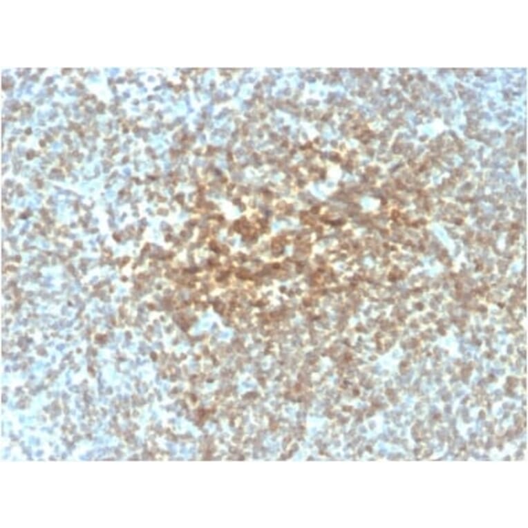 Immunohistochemistry (formalin-fixed, paraffin-embedded) - Anti-Bcl-2 Antibody [rBCL2/782] (Biotin) (A353868) - Antibodies.com