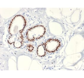 Immunohistochemistry (formalin-fixed, paraffin-embedded) - Anti-Estrogen Receptor alpha Antibody [ESR1/2299R] (CF®405S) (A353869) - Antibodies.com
