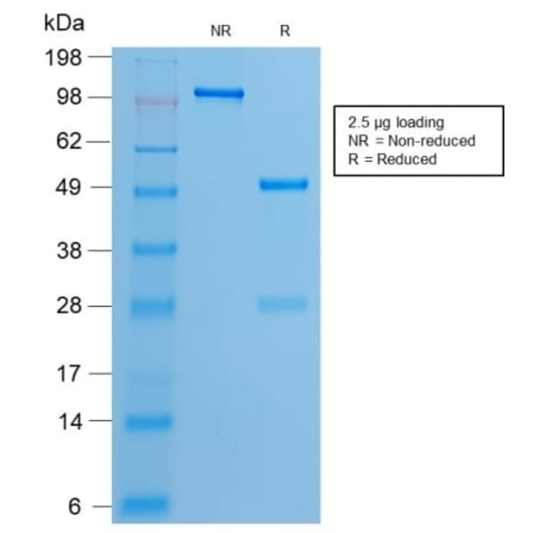 SDS-PAGE - Anti-Estrogen Receptor alpha Antibody [ESR1/2299R] (CF®647) (A353871) - Antibodies.com