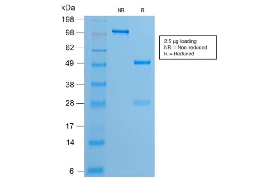 SDS-PAGE - Anti-Estrogen Receptor alpha Antibody [ESR1/2299R] (CF®740) (A353873) - Antibodies.com