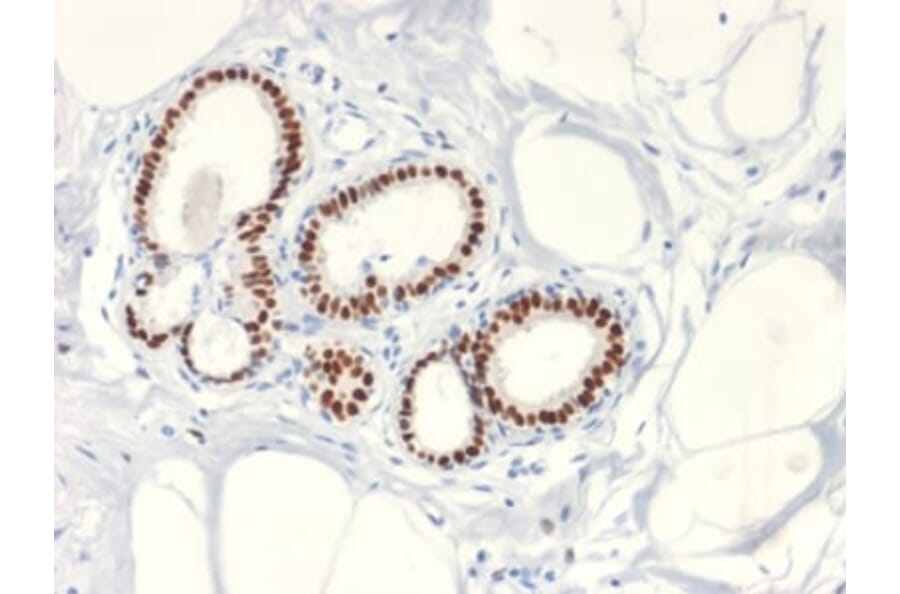 Immunohistochemistry (formalin-fixed, paraffin-embedded) - Anti-Estrogen Receptor alpha Antibody [ESR1/2299R] (CF®488A) (A353874) - Antibodies.com