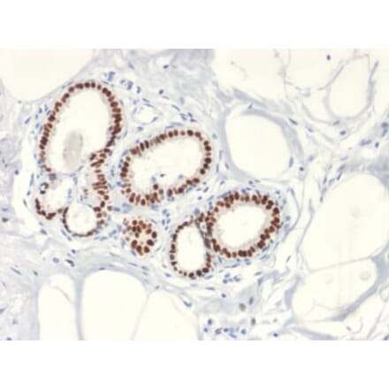 Immunohistochemistry (formalin-fixed, paraffin-embedded) - Anti-Estrogen Receptor alpha Antibody [ESR1/2299R] (CF®488A) (A353874) - Antibodies.com