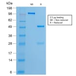 SDS-PAGE - Anti-Estrogen Receptor alpha Antibody [ESR1/2299R] (CF®488A) (A353874) - Antibodies.com
