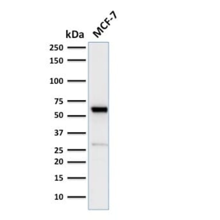 Wstern Blot - Anti-Estrogen Receptor alpha Antibody [ESR1/2299R] (CF®488A) (A353874) - Antibodies.com