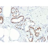 Immunohistochemistry (formalin-fixed, paraffin-embedded) - Anti-Estrogen Receptor alpha Antibody [rESR1/1935] (CF®405S) (A353877) - Antibodies.com