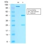 SDS-PAGE - Anti-Estrogen Receptor alpha Antibody [rESR1/1935] (CF®405S) (A353877) - Antibodies.com
