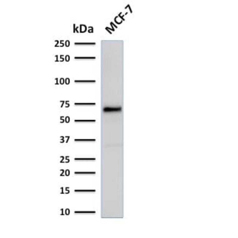 Wstern Blot - Anti-Estrogen Receptor alpha Antibody [rESR1/1935] (CF®405S) (A353877) - Antibodies.com