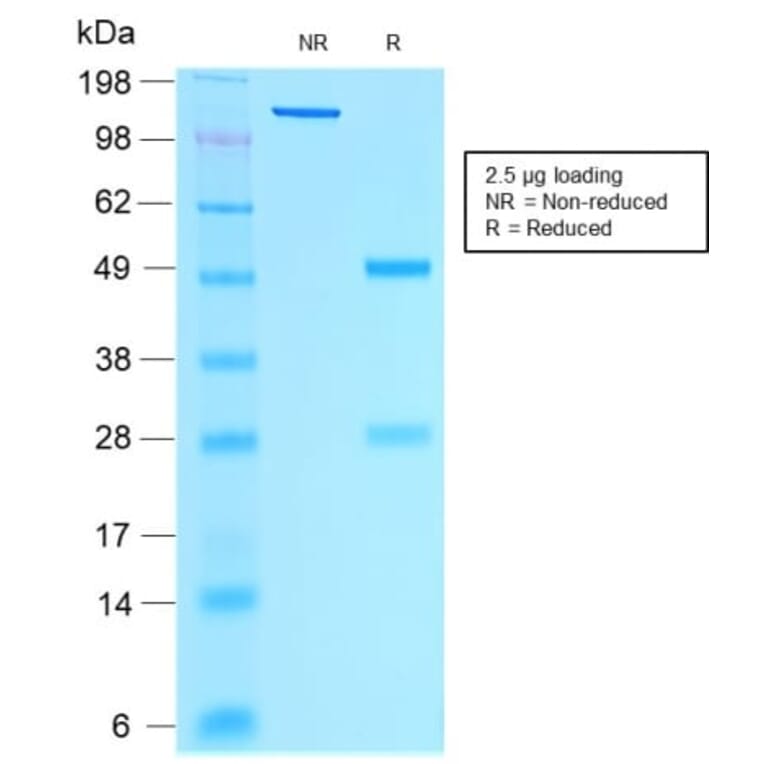SDS-PAGE - Anti-Estrogen Receptor alpha Antibody [rESR1/1935] (CF®640R) (A353878) - Antibodies.com