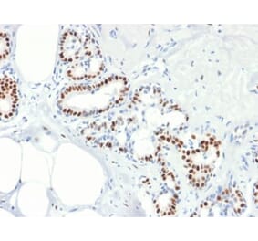 Immunohistochemistry (formalin-fixed, paraffin-embedded) - Anti-Estrogen Receptor alpha Antibody [rESR1/1935] (CF®488A) (A353882) - Antibodies.com