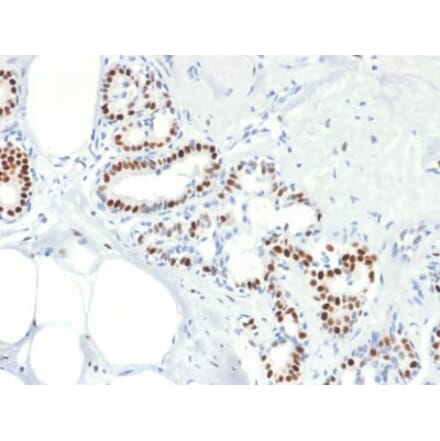 Immunohistochemistry (formalin-fixed, paraffin-embedded) - Anti-Estrogen Receptor alpha Antibody [rESR1/1935] (CF®488A) (A353882) - Antibodies.com