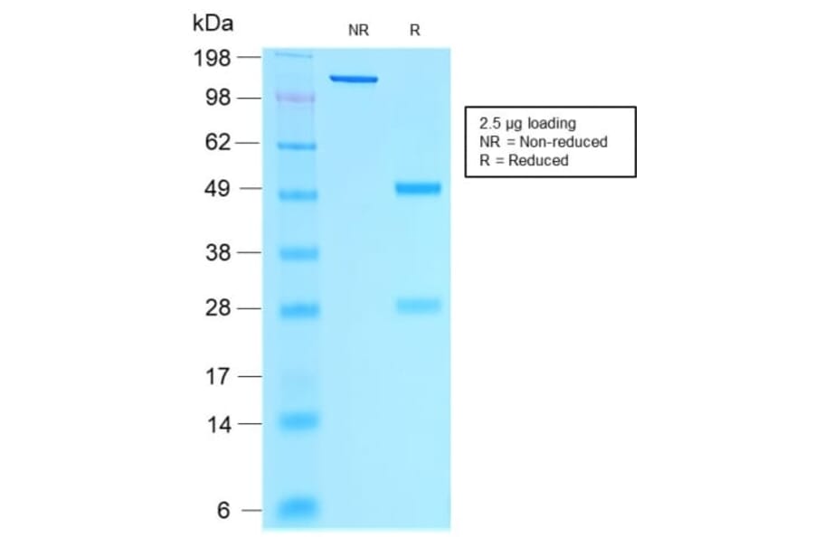 SDS-PAGE - Anti-Estrogen Receptor alpha Antibody [rESR1/1935] (CF®488A) (A353882) - Antibodies.com