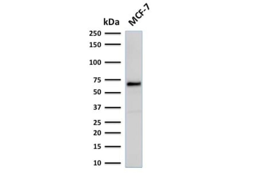 Wstern Blot - Anti-Estrogen Receptor alpha Antibody [rESR1/1935] (CF®488A) (A353882) - Antibodies.com