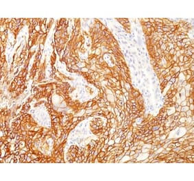 Immunohistochemistry (formalin-fixed, paraffin-embedded) - Anti-EGFR Antibody [GFR/2341] (CF®405S) (A353885) - Antibodies.com