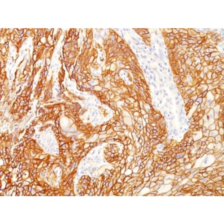Immunohistochemistry (formalin-fixed, paraffin-embedded) - Anti-EGFR Antibody [GFR/2341] (CF®405S) (A353885) - Antibodies.com