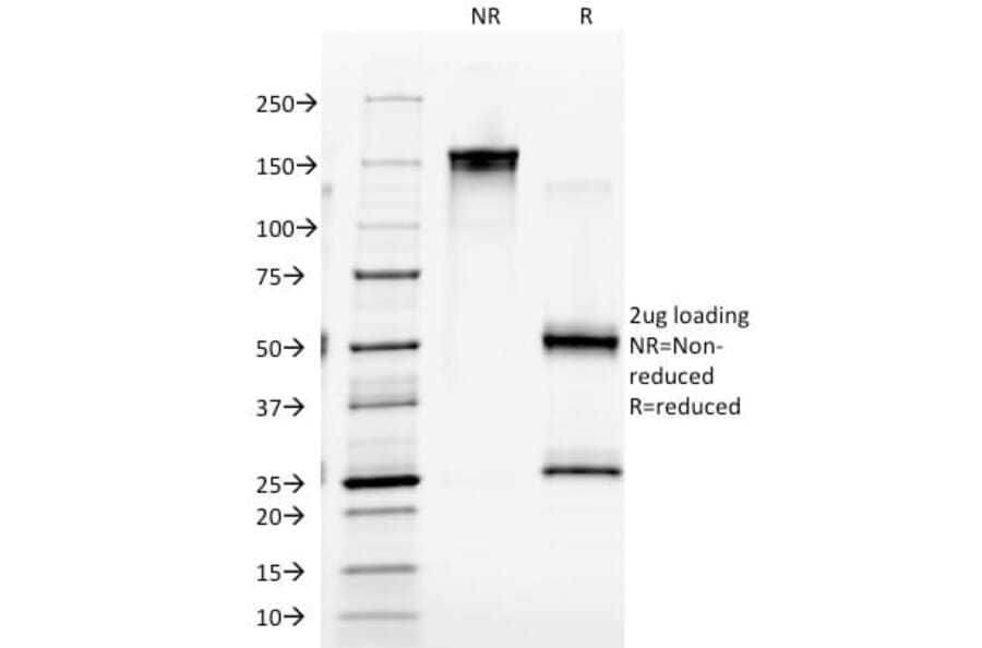 SDS-PAGE - Anti-EGFR Antibody [GFR/2341] (CF®405S) (A353885) - Antibodies.com