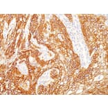 Immunohistochemistry (formalin-fixed, paraffin-embedded) - Anti-EGFR Antibody [GFR/2341] (CF®740) (A353889) - Antibodies.com