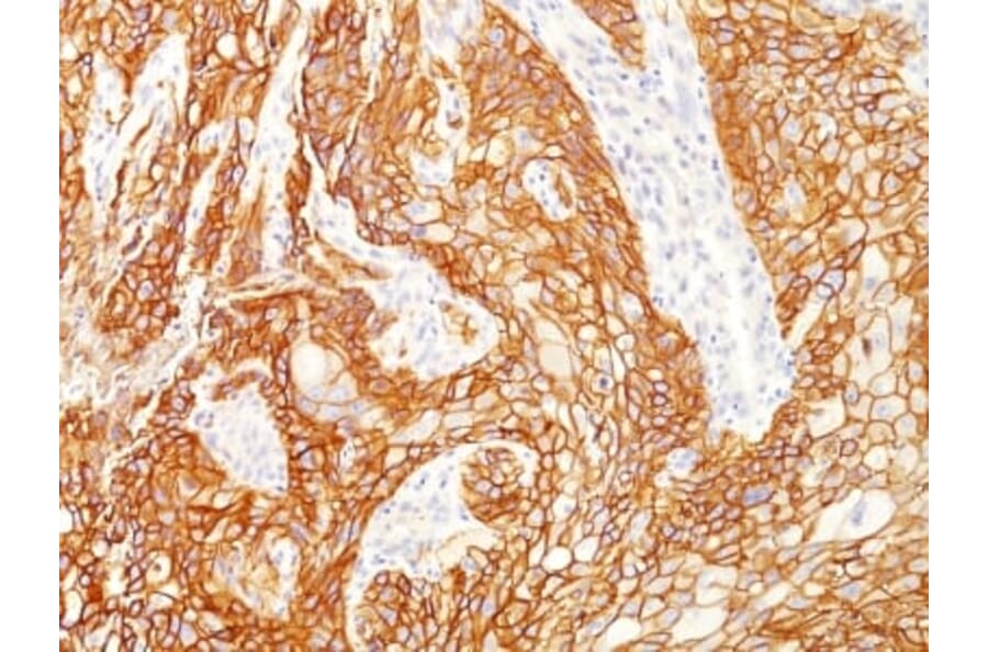 Immunohistochemistry (formalin-fixed, paraffin-embedded) - Anti-EGFR Antibody [GFR/2341] (CF®488A) (A353890) - Antibodies.com