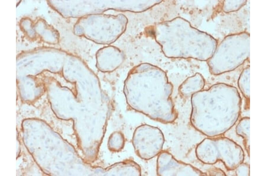 Immunohistochemistry (formalin-fixed, paraffin-embedded) - Anti-EGFR Antibody [GFR/2341] (CF®488A) (A353890) - Antibodies.com